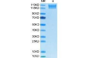 SEZ6L2 Protein (AA 28-844) (His tag)