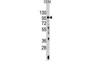 Western blot analysis of PIK3CG polyclonal antibody  in CEM cell lysate (35 ug/lane). (PIK3 gamma antibody  (Ser1100))