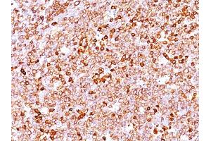 Formalin-fixed, paraffin-embedded human Tonsil stained with CD79a Rabbit Recombinant Monoclonal Antibody (IGA/1688R).