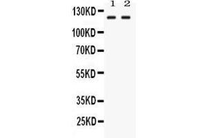 Western Blotting (WB) image for anti-Leucine-Rich Repeats and Immunoglobulin-Like Domains 3 (LRIG3) (AA 428-465), (Middle Region) antibody (ABIN4886661)