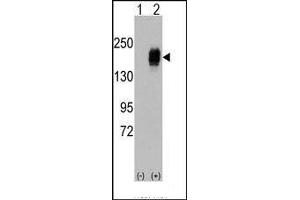 Western blot analysis of EGFR (arrow) using rabbit polyclonal EGFR Antibody. (EGFR antibody  (Tyr987))