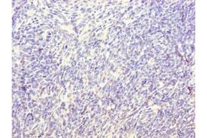 Immunohistochemistry of paraffin-embedded human thymus tissue using ABIN7171361 at dilution of 1:100 (TRIM antibody  (AA 29-186))