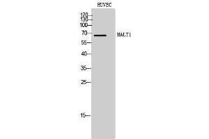 Western Blotting (WB) image for anti-Mucosa Associated Lymphoid Tissue Lymphoma Translocation Gene 1 (MALT1) (Internal Region) antibody (ABIN3185445)