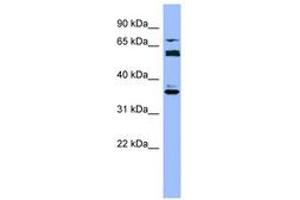 Image no. 1 for anti-Cytochrome P450, Family 2, Subfamily B, Polypeptide 6 (CYP2B6) (AA 215-264) antibody (ABIN6749723) (CYP2B6 antibody  (AA 215-264))
