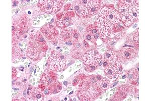 Immunohistochemistry (IHC) image for anti-Mitogen-Activated Protein Kinase Kinase 2 (MAP2K2) (N-Term) antibody (ABIN2783572) (MEK2 antibody  (N-Term))