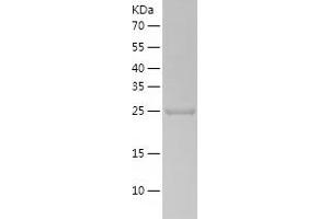MED20 Protein (AA 1-212) (His tag)