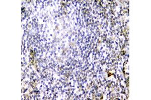 IHC analysis of CD84 using anti-CD84 antibody (ABIN6719602). (CD84 antibody  (AA 22-225))