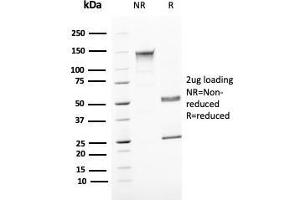 SDS-PAGE Analyis Purified Uroplakin 1B Mouse Monoclonal Antibody (UPK1B/3081). (Uroplakin 1B antibody  (AA 109-229))