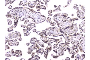 Immunohistochemistry (IHC) image for anti-T-Complex 1 (TCP1) (AA 515-551), (C-Term) antibody (ABIN5693078)
