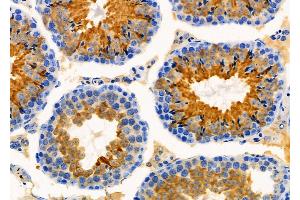 ABIN6260461 and ABIN6276363 at 1/100 staining Mouse testis tissue by IHC-P. (CARD8 antibody  (Internal Region))