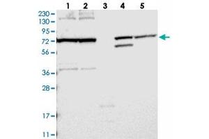 Western blot analysis of Lane 1: RT-4, Lane 2: U-251 MG, Lane 3: Human Plasma, Lane 4: Liver, Lane 5: Tonsil with FAM161B polyclonal antibody  at 1:250-1:500 dilution. (FAM161B antibody)
