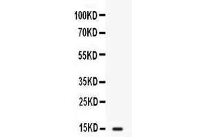 Western blot analysis of FABP2/I-FABP expression in SW620 whole cell lysates ( Lane 1). (FABP2 antibody  (N-Term))