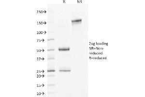 SDS-PAGE Analysis Purified ALDH1A1 Mouse Monoclonal Antibody (ALDH1A1/1381). (ALDH1A1 antibody  (AA 315-434))
