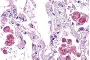 Human Lung: Formalin-Fixed, Paraffin-Embedded (FFPE) (HNF1A antibody  (AA 179-228))