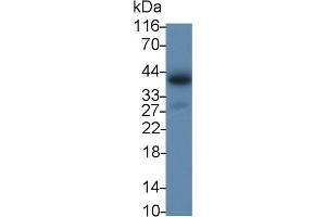 Detection of IL2Rg in Porcine Lymph node lysate using Polyclonal Antibody to Interleukin 2 Receptor Gamma (IL2Rg) (IL2RG antibody  (AA 23-262))