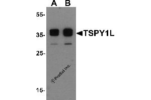 Western Blotting (WB) image for anti-TSPY1L (C-Term) antibody (ABIN1077408) (TSPY1L (C-Term) antibody)