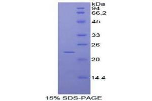 SDS-PAGE analysis of Human RAD54 Like Protein 2 Protein. (ARIP4 Protein)