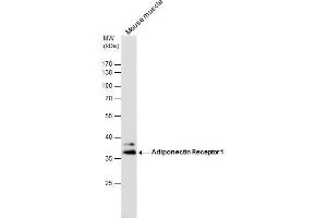 WB Image Adiponectin Receptor 1 antibody detects Adiponectin Receptor 1 protein by western blot analysis. (Adiponectin Receptor 1 antibody  (C-Term))