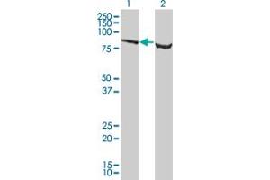 Western Blot analysis of SP1 expression in transfected 293T cell line by SP1 monoclonal antibody (M05), clone 4B11. (SP1 antibody  (AA 522-618))