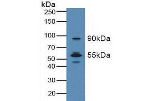 Figure. (MST1R antibody  (AA 1092-1316))