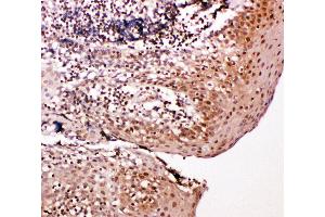 Anti-Caspase-14 antibody, IHC(P) IHC(P): Human Tonsil Tissue