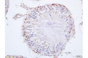Formalin-fixed and paraffin embedded rat testis labeled with Anti-SEPT14 Polyclonal Antibody, Unconjugated  at 1:200 followed by conjugation to the secondary antibody and DAB staining (Septin 14 antibody  (AA 351-432))