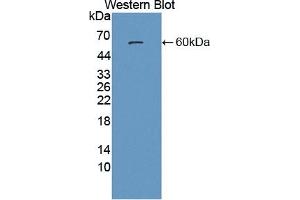 Detection of Recombinant PSAP, Human using Polyclonal Antibody to Prosaposin (PSAP) (Prosaposin antibody  (AA 17-524))