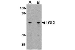 Image no. 1 for anti-Leucine-Rich Repeat LGI Family, Member 2 (LGI2) (N-Term) antibody (ABIN1494389) (LGI2 antibody  (N-Term))