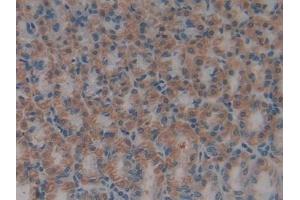 Immunohistochemistry (IHC) image for anti-High Mobility Group Box 1 (HMGB1) (AA 1-215) antibody (ABIN7431746)