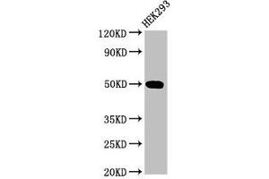 Western Blot Positive WB detected in: HEK293 whole cell lysate All lanes: TGFB1I1 antibody at 3. (TGFB1I1 antibody  (AA 138-200))