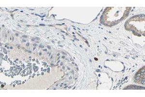 ABIN6269106 at 1/100 staining Human prostate tissue by IHC-P.