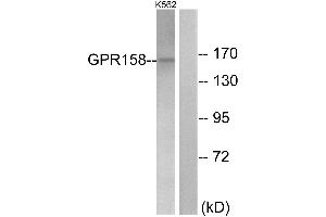 Immunohistochemistry analysis of paraffin-embedded human brain tissue using GPR158 antibody. (GPR158 antibody  (Internal Region))
