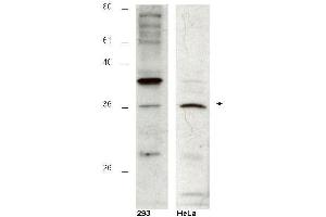 Western blot using  affinity purified anti-Hus1B antibody shows detection of a 36kDa band corresponding to Hus1B in a HeLa cell lysate (arrowhead). (HUS1 Checkpoint Homolog B (HUS1B) Peptide)