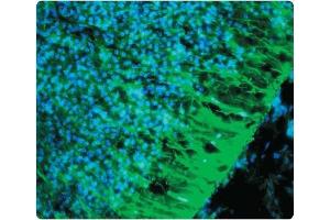 A tissue section through an e13 Mouse brain showing Nestin (green staining) in neural stem cells of the ventricular zone of the CNS. (Nestin antibody)
