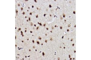 Immunohistochemistry (IHC) image for anti-Ubiquitin-Conjugating Enzyme E2B (UBE2B) antibody (ABIN7271173)