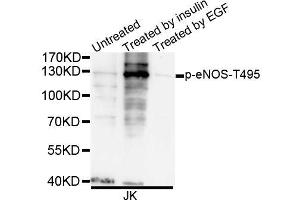 Western blot analysis of extracts of JK cells, using Phospho-eNOS-T495 antibody (ABIN5995598). (ENOS antibody  (pTyr495))