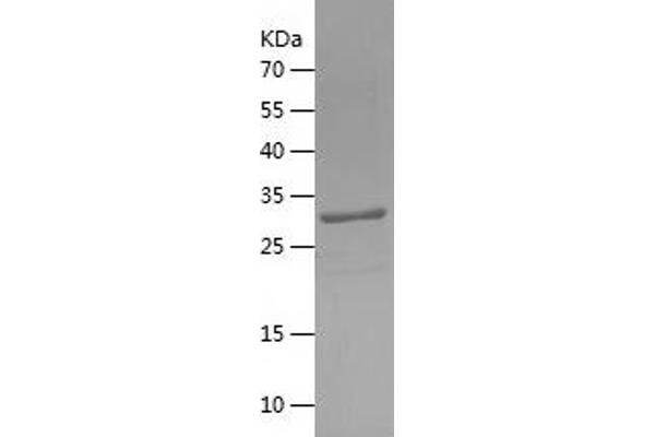 C14orf169 + NO66 Protein (AA 169-433) (His tag)