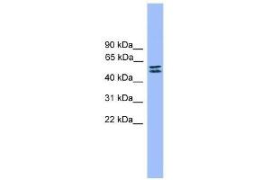 Western Blot showing SPINT1 antibody used at a concentration of 1-2 ug/ml to detect its target protein.