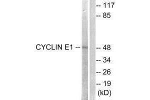 Western blot analysis of extracts from HeLa cells, treated with Paclitasel (1uM, 60 mins), using Cyclin E1 (Ab-395) antibody. (Cyclin E1 antibody  (Thr395))