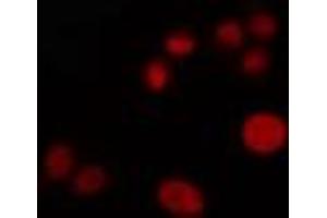ABIN6274277 staining HuvEc cells by IF/ICC. (ZNF75 antibody  (Internal Region))
