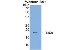 Detection of Recombinant CEA, Human using Polyclonal Antibody to Carcinoembryonic Antigen (CEA) (CEA antibody  (AA 75-219))