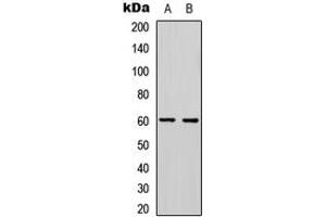 Western blot analysis of PDCD4 (pS457) expression in HeLa (A), Jurkat (B) whole cell lysates. (PDCD4 antibody  (C-Term, pSer457))