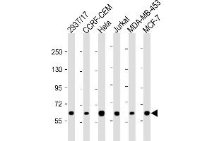 All lanes : Anti-RNF31 Antibody (C-term) at 1:2000 dilution Lane 1: 293T/17 whole cell lysate Lane 2: CCRF-CEM whole cell lysate Lane 3: Hela whole cell lysate Lane 4: Jurkat whole cell lysate Lane 5: MDA-MB-453 whole cell lysate Lane 6: MCF-7 whole cell lysate Lysates/proteins at 20 μg per lane. (RNF31 antibody  (C-Term))