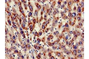 Immunohistochemistry of paraffin-embedded human liver tissue using ABIN7157524 at dilution of 1:100 (KIR3DL1 antibody  (AA 81-336))