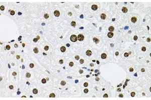 Immunohistochemistry of paraffin-embedded Mouse liver using MCL1 Polyclonal Antibody at dilution of 1:100 (40x lens). (MCL-1 antibody)