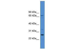 WB Suggested Anti-SLC13A3 Antibody Titration:  0.