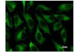 Immunostaining analysis in HeLa cells. (ZW10 antibody)