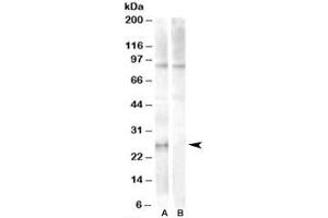 Western blot testing of human heart lysate with APOBEC2 antibody at 1ug/ml with [B] and without [A] blocking peptide. (APOBEC2 antibody)