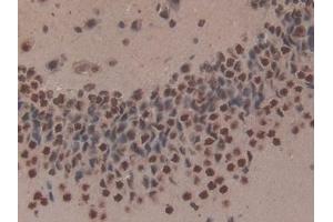 Detection of NME6 in Rat Cerebrum Tissue using Polyclonal Antibody to Non Metastatic Cells 6, Protein Expressed In (NME6) (Non Metastatic Cells 6, Protein Expressed In (AA 1-173) antibody)