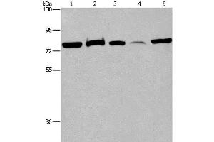 Western Blot analysis of 293T cell, Human fetal brain tissue and K562 cell, Human fetal liver tissue and Hela cell using ACVR2A Polyclonal Antibody at dilution of 1:400 (ACVR2A antibody)